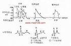 小儿醛固酮过多症