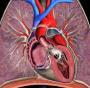 肺動脈高壓