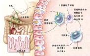 蛋白丢失性胃肠病