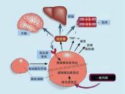 胰岛素抵抗与代谢综合征