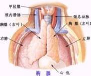 Nezelot综合征