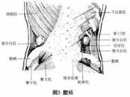 腰疝_腰疝症状_腰疝治疗 - 120健康网