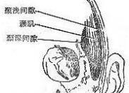 颞间隙感染