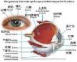 眼球穿通伤