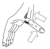 拇指掌指关节尺侧侧副韧带损伤