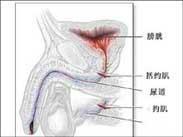 主要表现为阴茎头有轻度疼痛,并见溃疡长期不.