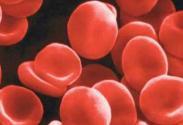 营养性巨幼红细胞性贫血