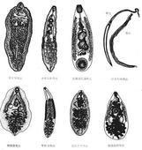 小儿片吸虫病