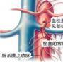 急性肠系膜上动脉栓塞或血栓形成