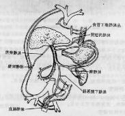 尼曼-皮克病