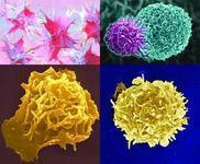 人类T淋巴细胞病毒感染