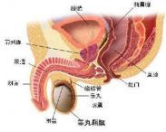 附睾畸形