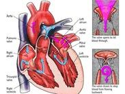 心脏瓣膜疾病