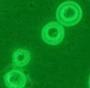 铜绿假单胞菌感染