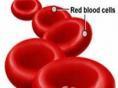 单纯红细胞再障性贫血