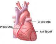 冠状动脉终止异常