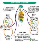 原发性阿米巴脑膜脑炎