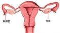 卵巢环管状性索肿瘤