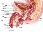 膀胱尿道异物