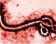 小儿埃博拉病毒病