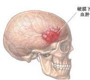 外伤性脑脓肿