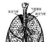 气管及支气管发育障碍