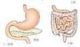 巨膀胱-小结肠-肠蠕动不良综合征