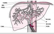 化脓性门静脉炎