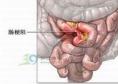小儿胃肠道异物及异物性肠梗阻