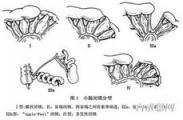 先天性结肠狭窄和闭锁