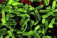 绿脓假单胞菌属感染