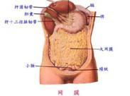 良性阵发性腹膜炎综合征