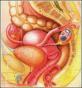 慢性输卵管卵巢炎