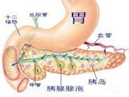 胰腺肉瘤