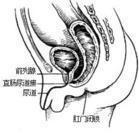 直肠重复畸形