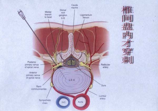 蔺卓华